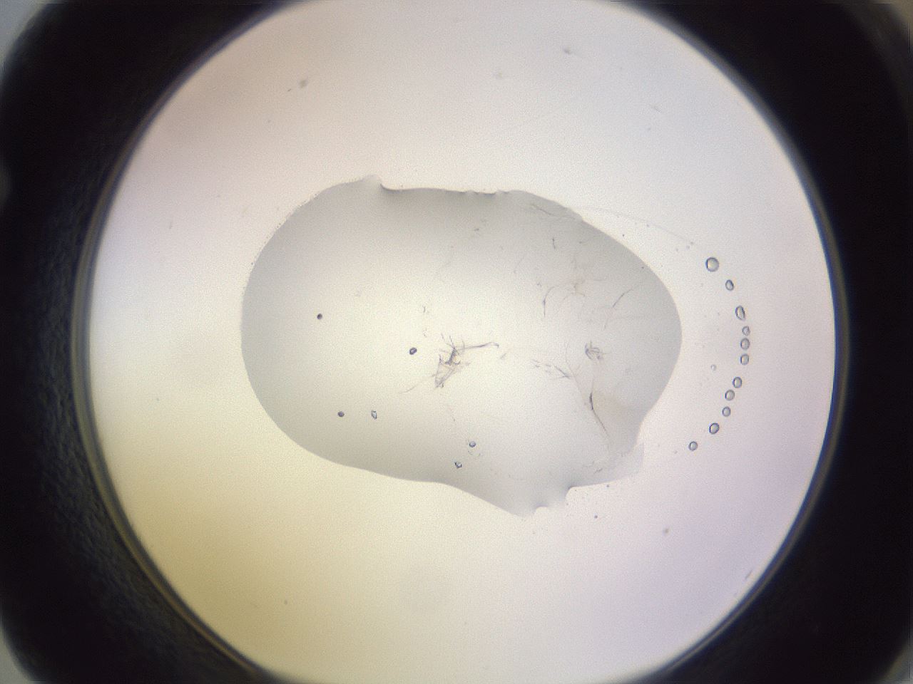 folderID419_plateID1419_batchID5194_wellNum62_profileID1_d1_r87055_ef.jpg