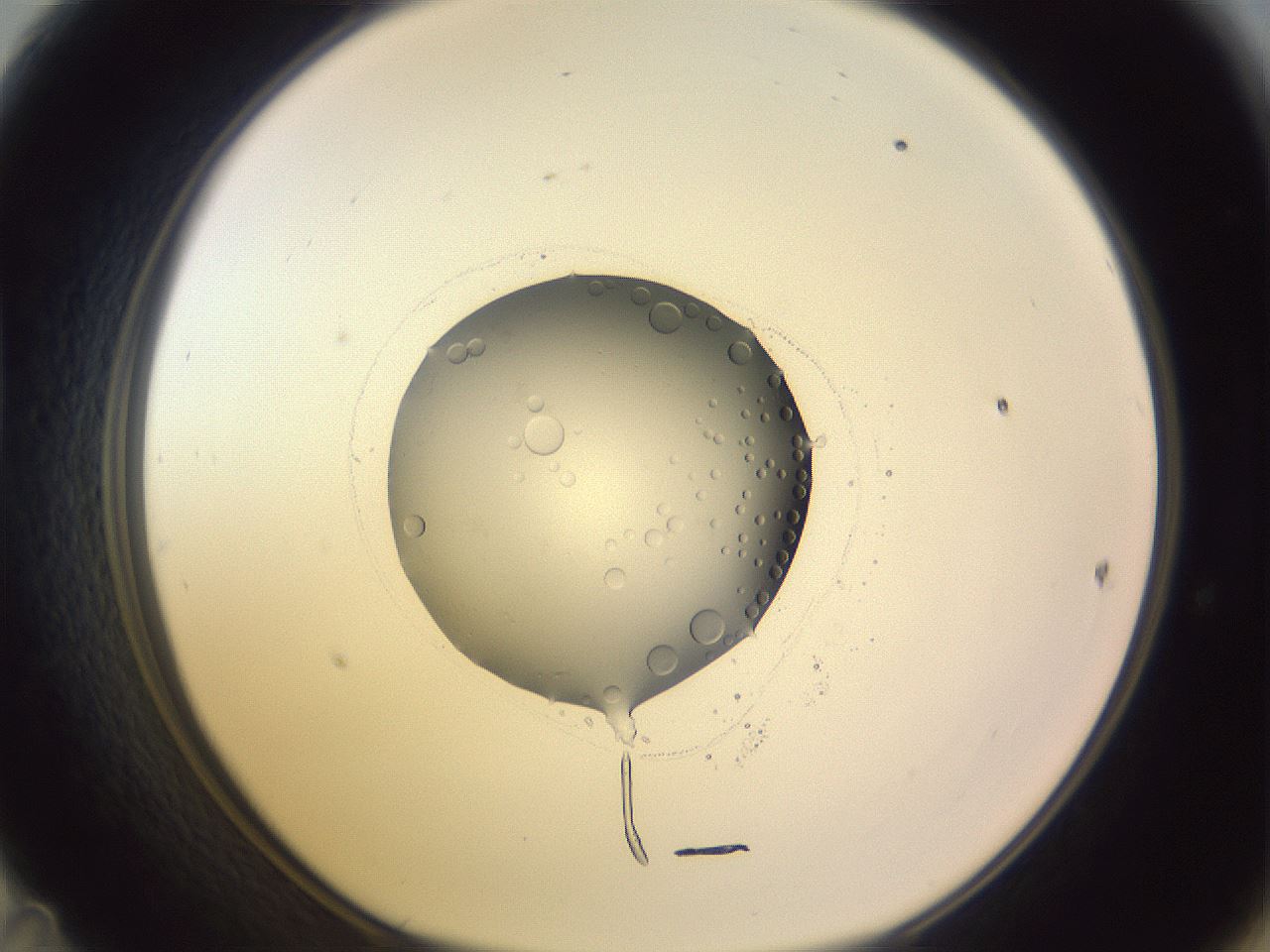 folderID419_plateID1419_batchID5194_wellNum47_profileID1_d1_r87040_ef.jpg