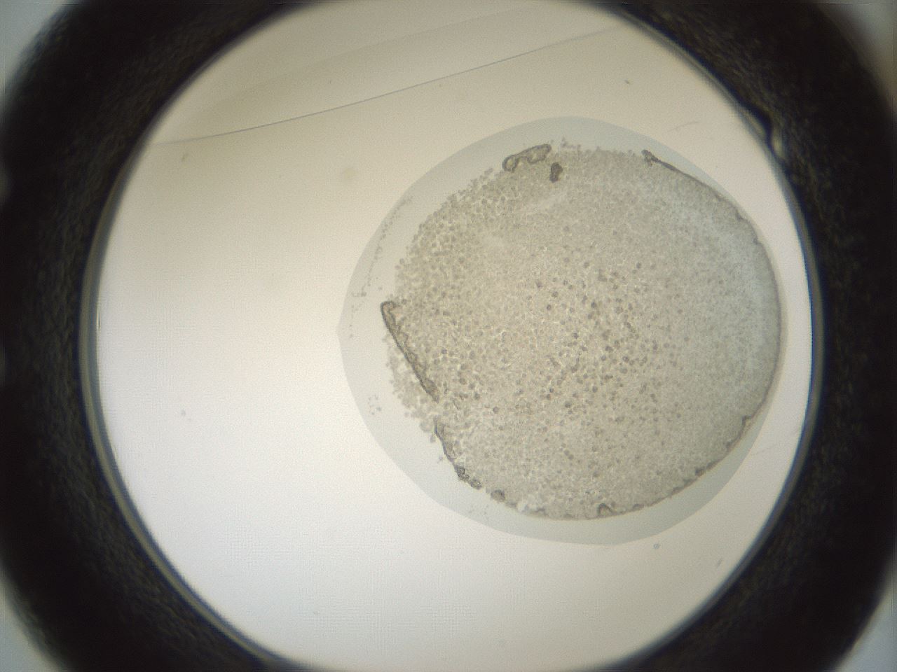 folderID428_plateID1428_batchID5438_wellNum49_profileID1_d1_r89977_ef.jpg
