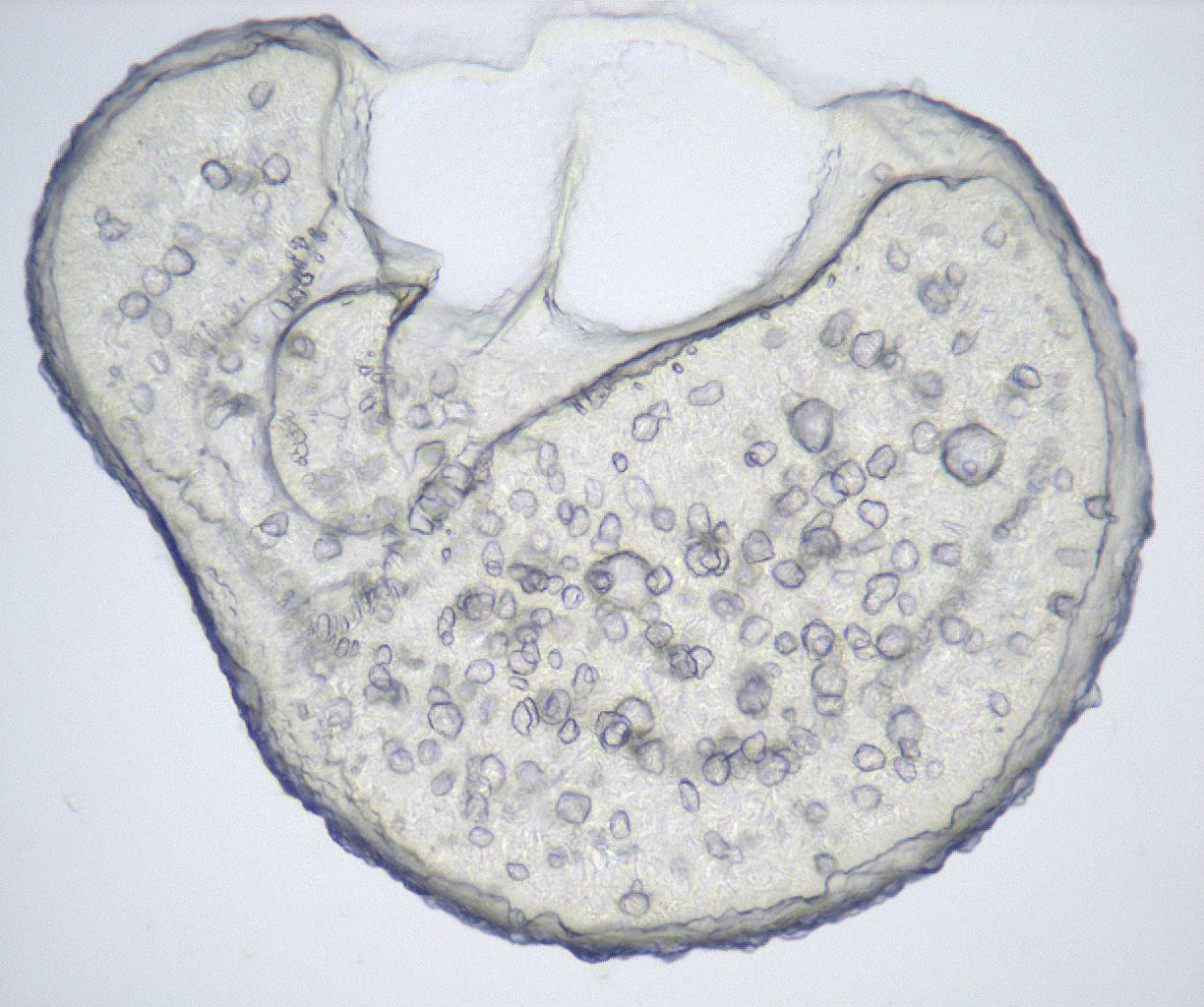 folderID428_plateID2428_batchID11768_wellNum70_profileID1_d1_r181514_ef.jpg