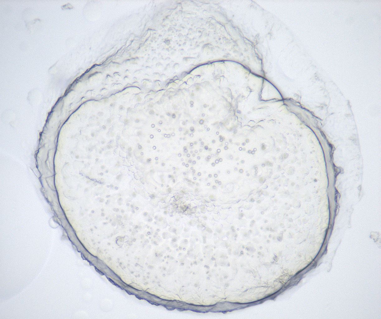 folderID429_plateID2429_batchID11733_wellNum40_profileID1_d1_r184622_ef.jpg