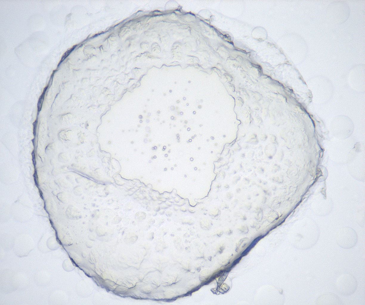 folderID429_plateID2429_batchID11733_wellNum46_profileID1_d1_r184634_ef.jpg