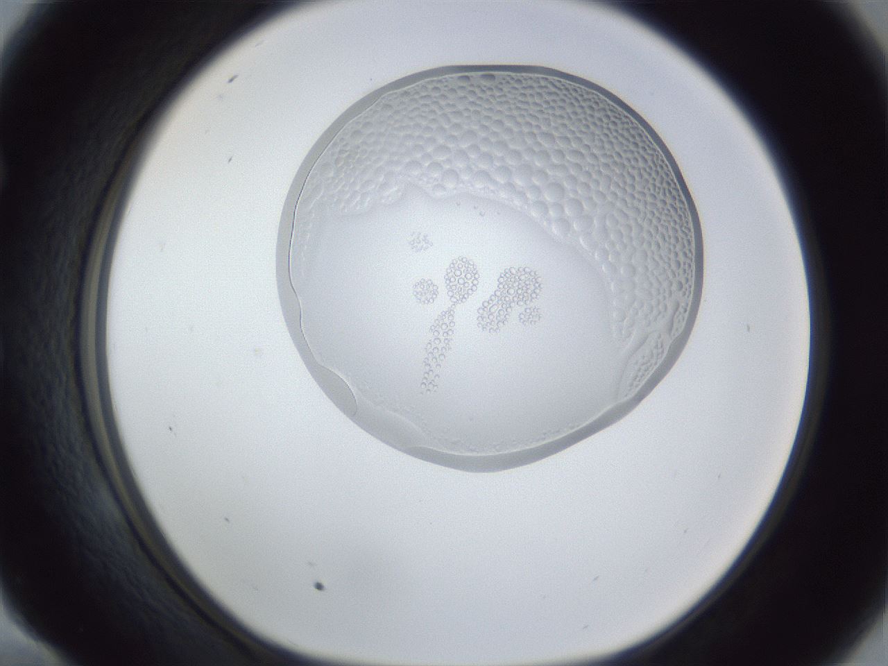 folderID166_plateID1166_batchID3122_wellNum58_profileID1_d1_r61393_ef.jpg