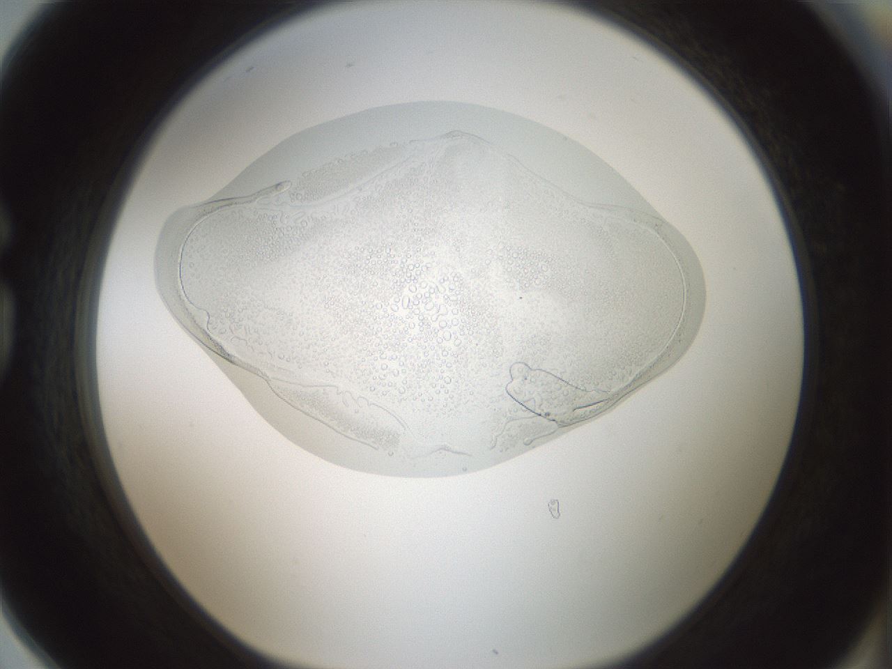 folderID431_plateID1431_batchID5431_wellNum78_profileID1_d1_r87923_ef.jpg