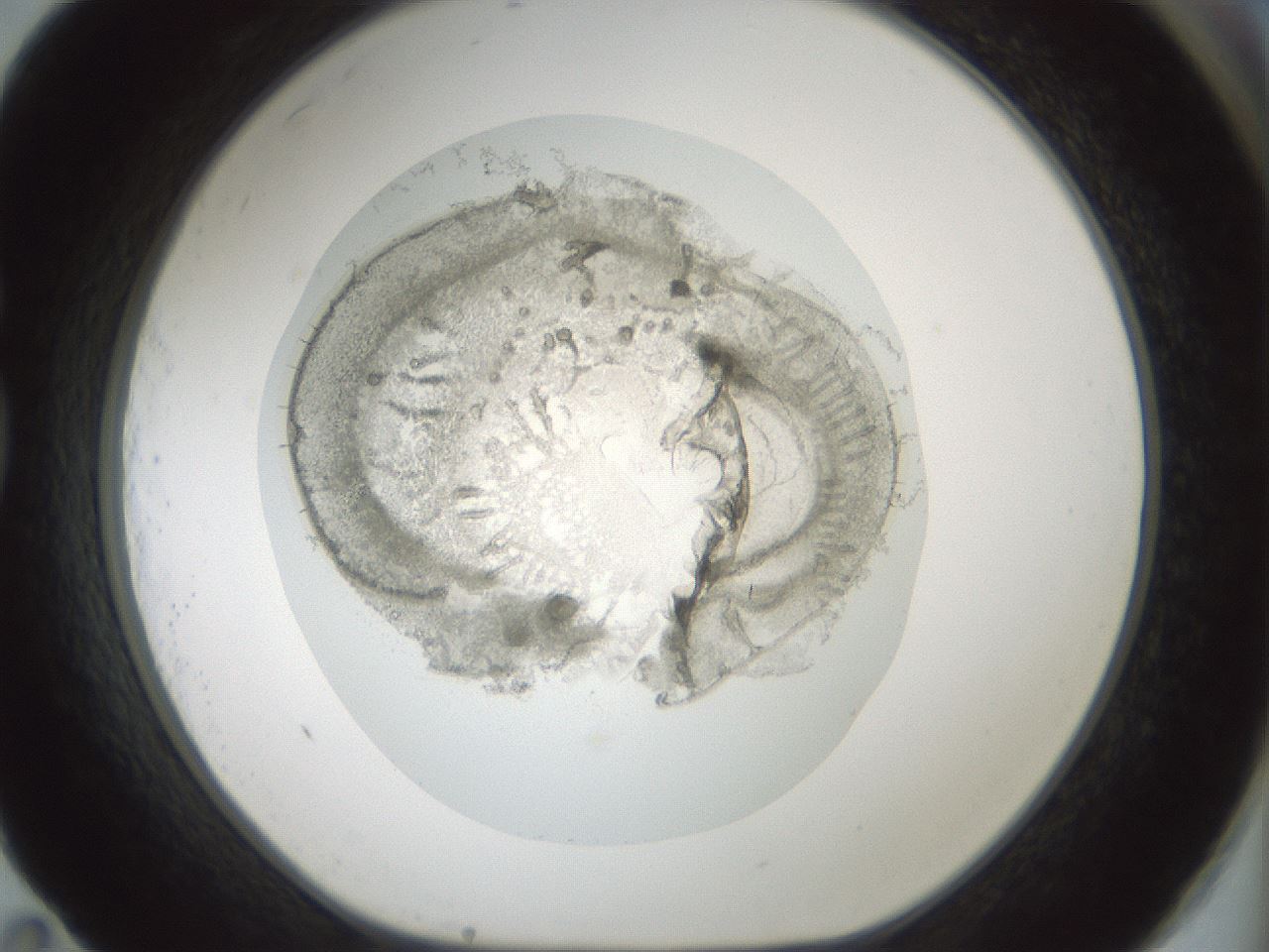 folderID431_plateID1431_batchID5431_wellNum83_profileID1_d1_r87933_ef.jpg