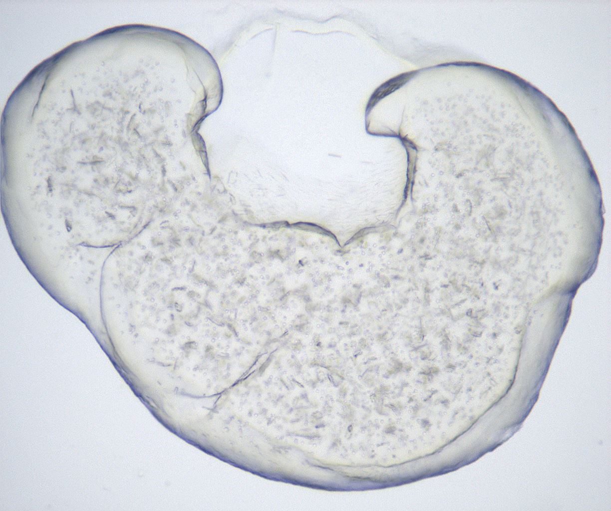 folderID432_plateID2432_batchID11736_wellNum72_profileID1_d1_r185262_ef.jpg