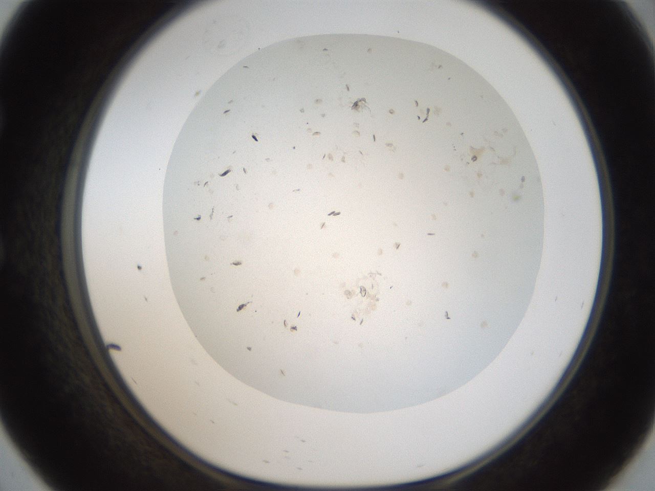 folderID44_plateID2044_batchID8995_wellNum57_profileID1_d1_r137711_ef.jpg