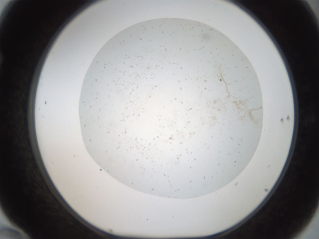 folderID44_plateID2044_batchID9009_wellNum70_profileID1_d1_r137724_ef.jpg