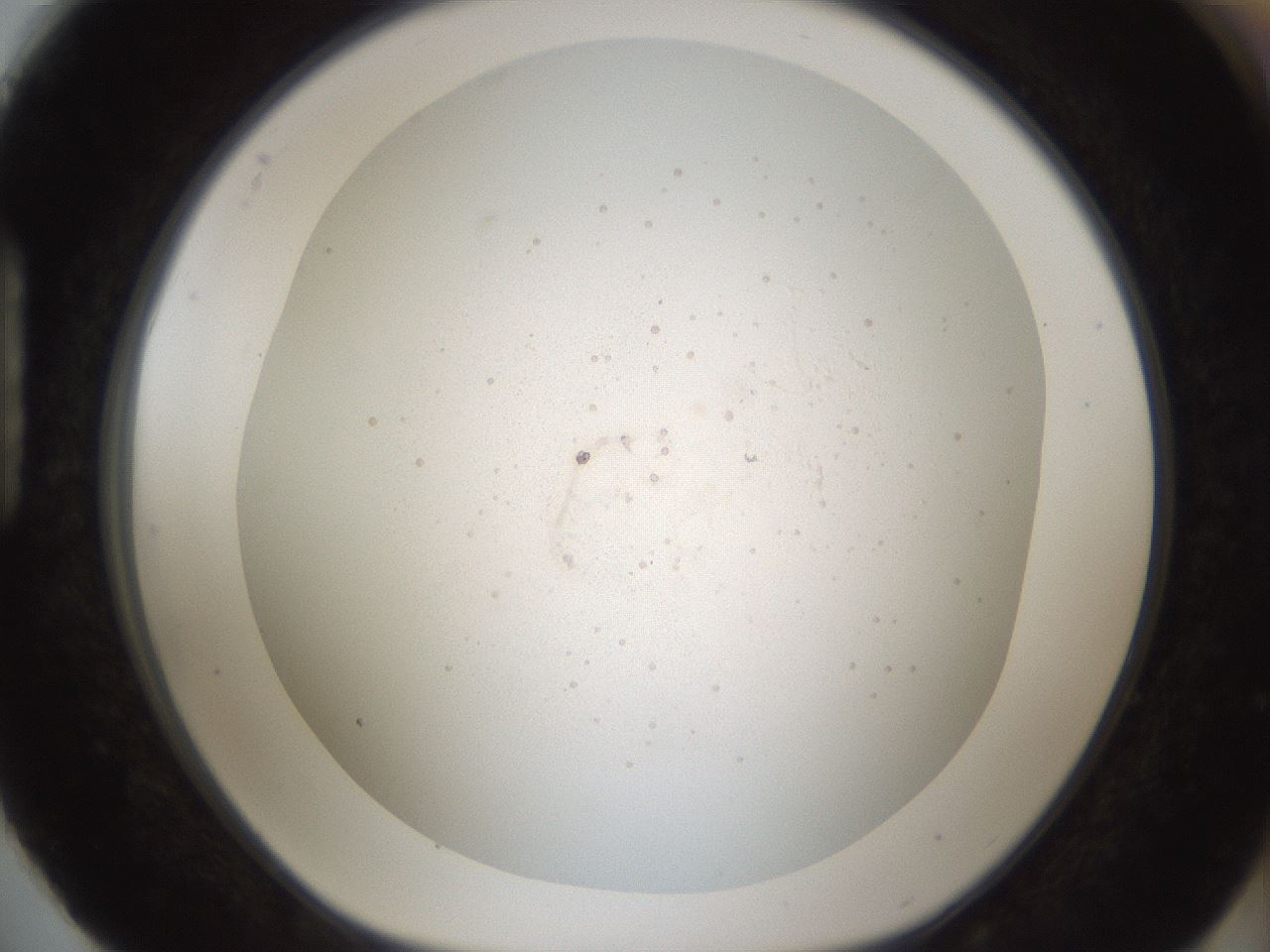 folderID44_plateID2044_batchID9009_wellNum88_profileID1_d1_r137742_ef.jpg