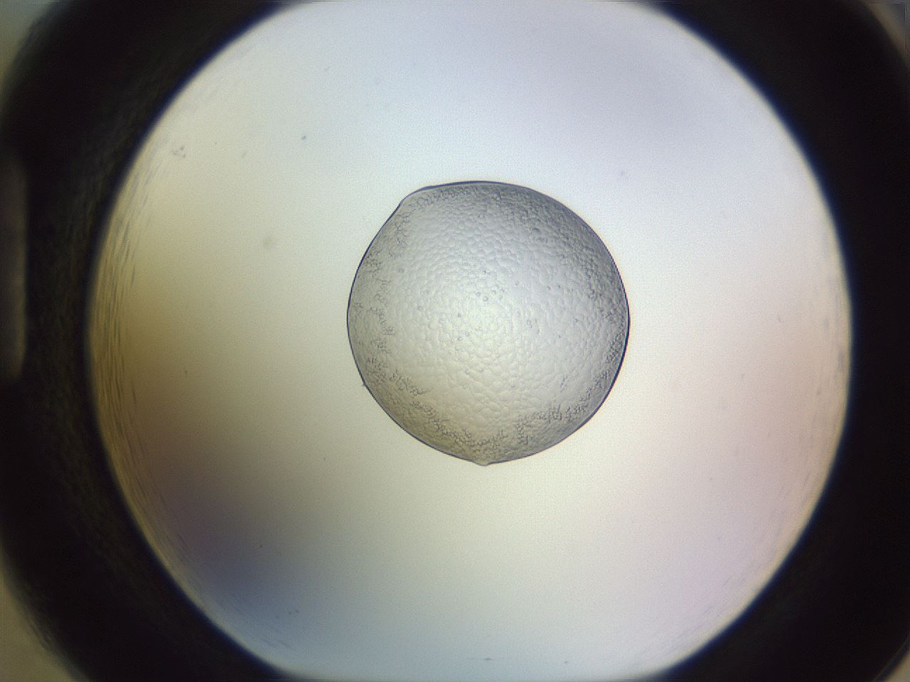 folderID451_plateID1451_batchID5526_wellNum85_profileID1_d1_r91888_ef.jpg