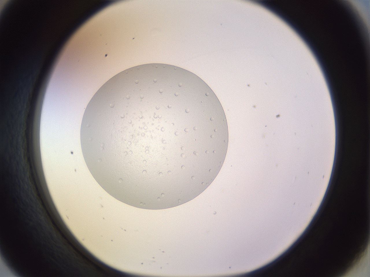 folderID453_plateID1453_batchID5528_wellNum57_profileID1_d1_r92148_ef.jpg