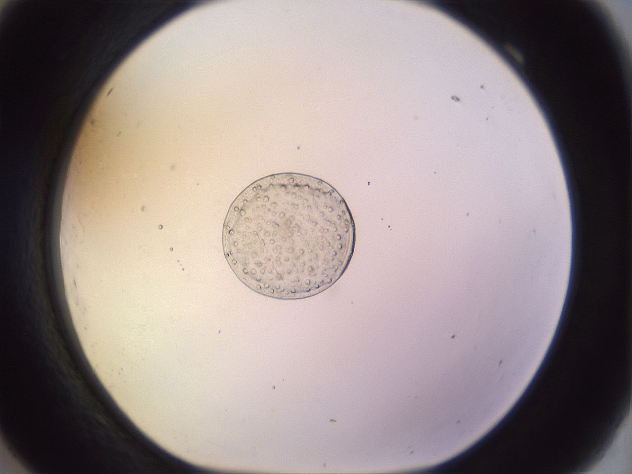 folderID453_plateID1453_batchID5528_wellNum69_profileID1_d1_r92160_ef.jpg