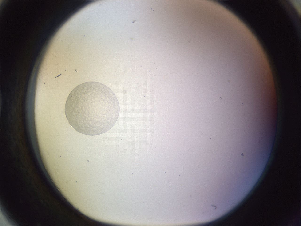 folderID453_plateID1453_batchID5528_wellNum79_profileID1_d1_r92170_ef.jpg