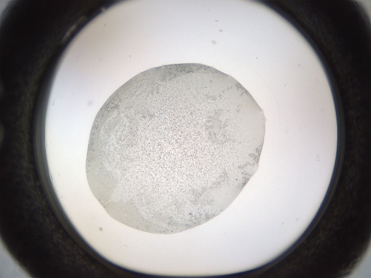 folderID515_plateID1515_batchID5948_wellNum28_profileID1_d1_r96455_ef.jpg