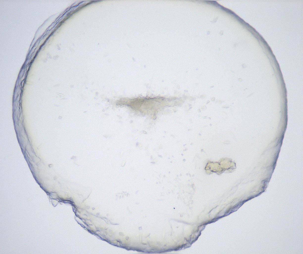 folderID528_plateID2528_batchID12500_wellNum16_profileID1_d1_r191746_ef.jpg