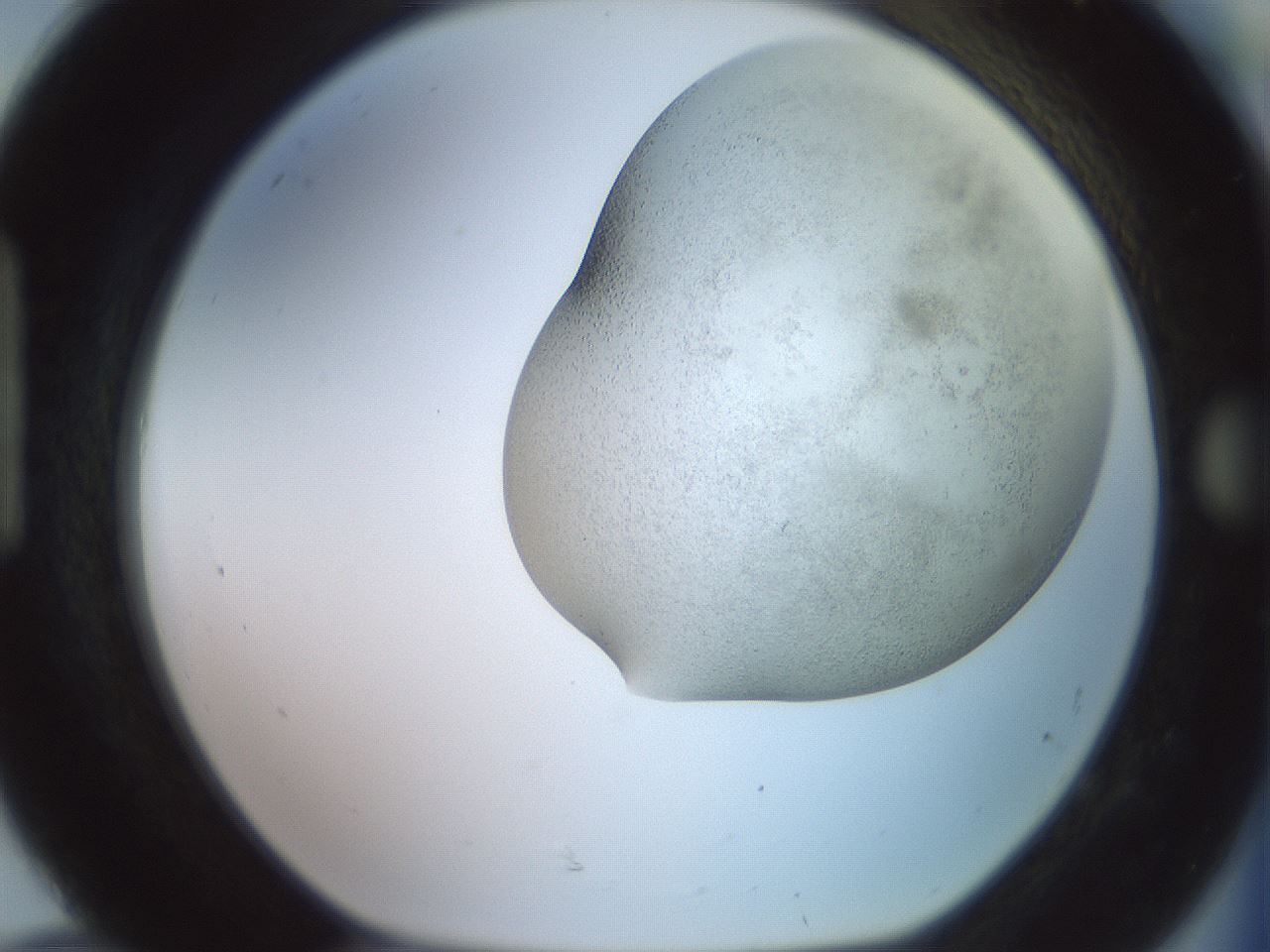 folderID559_plateID2559_batchID12940_wellNum92_profileID1_d1_r196127_ef.jpg