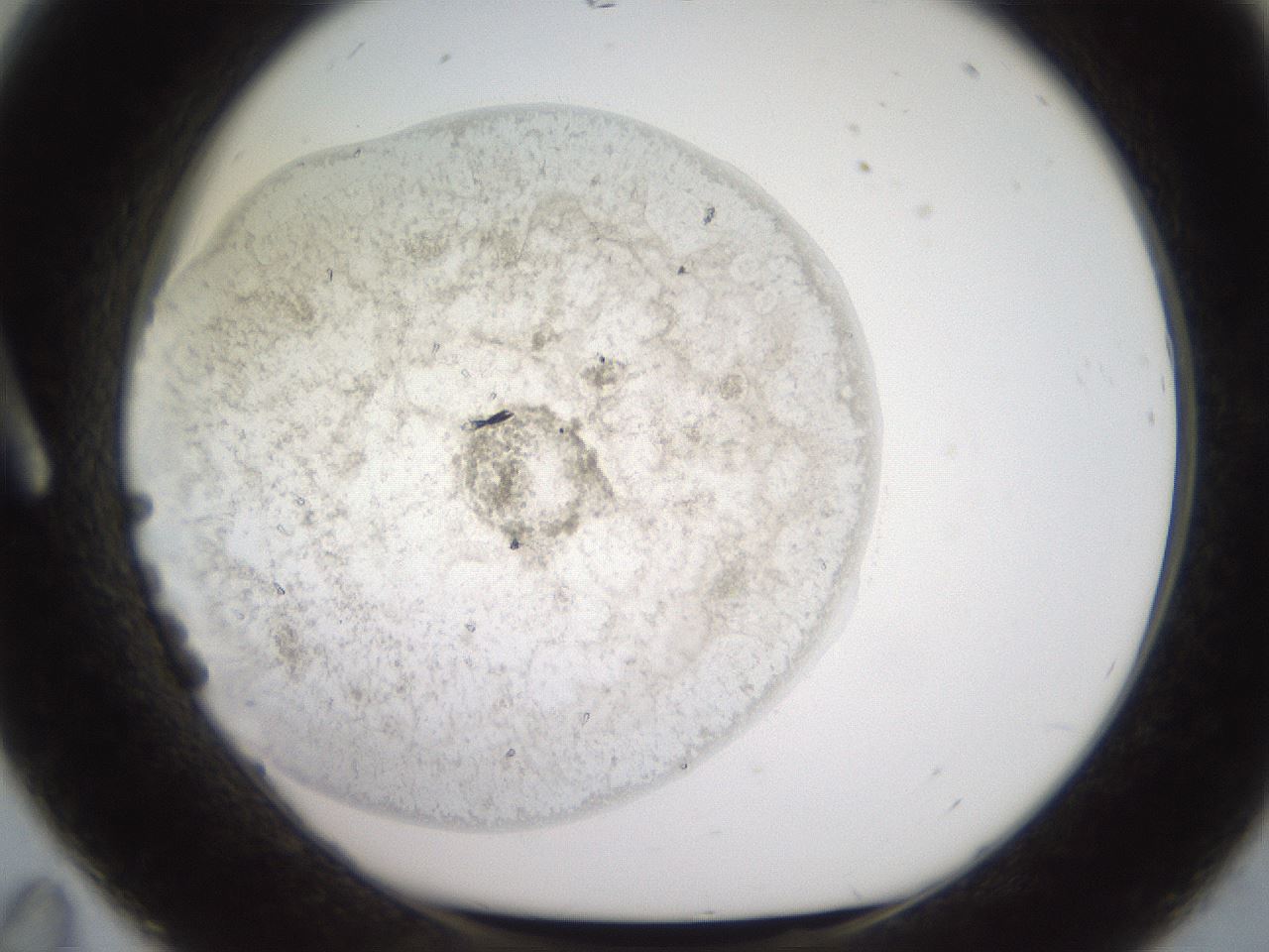 folderID569_plateID2569_batchID12915_wellNum11_profileID1_d1_r196157_ef.jpg