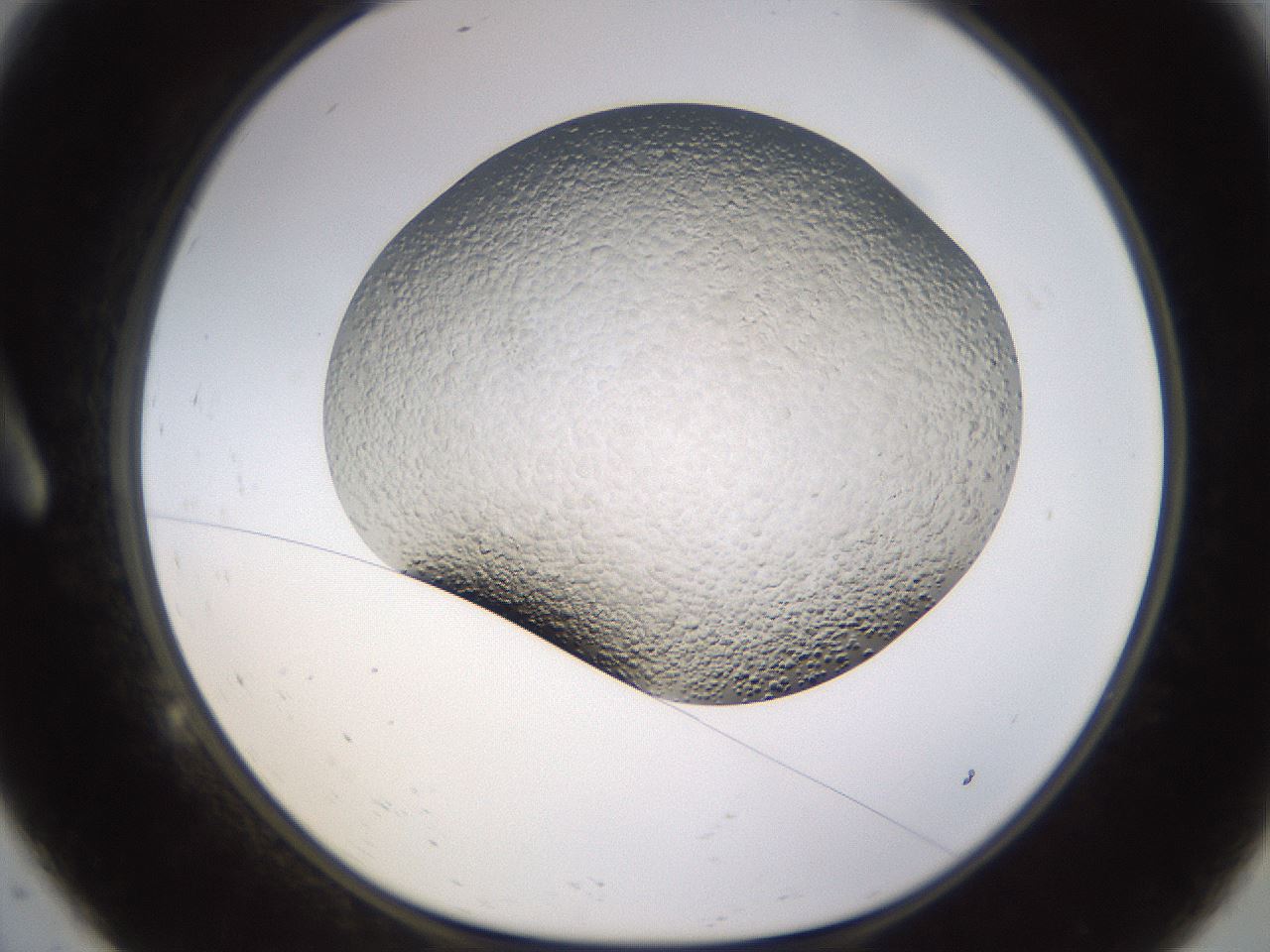 folderID570_plateID1570_batchID6367_wellNum9_profileID1_d1_r102647_ef.jpg