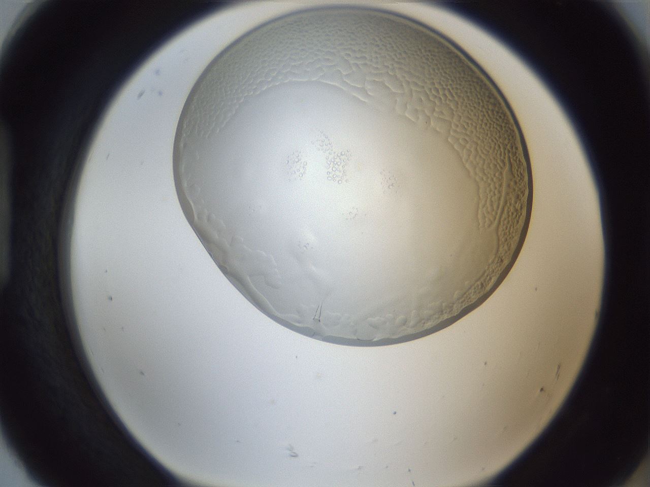 folderID205_plateID1205_batchID3629_wellNum92_profileID1_d1_r66934_ef.jpg