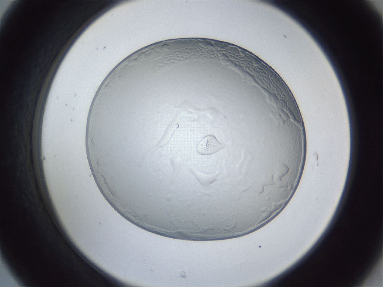 folderID205_plateID1205_batchID3675_wellNum31_profileID1_d2_r66813_ef.jpg