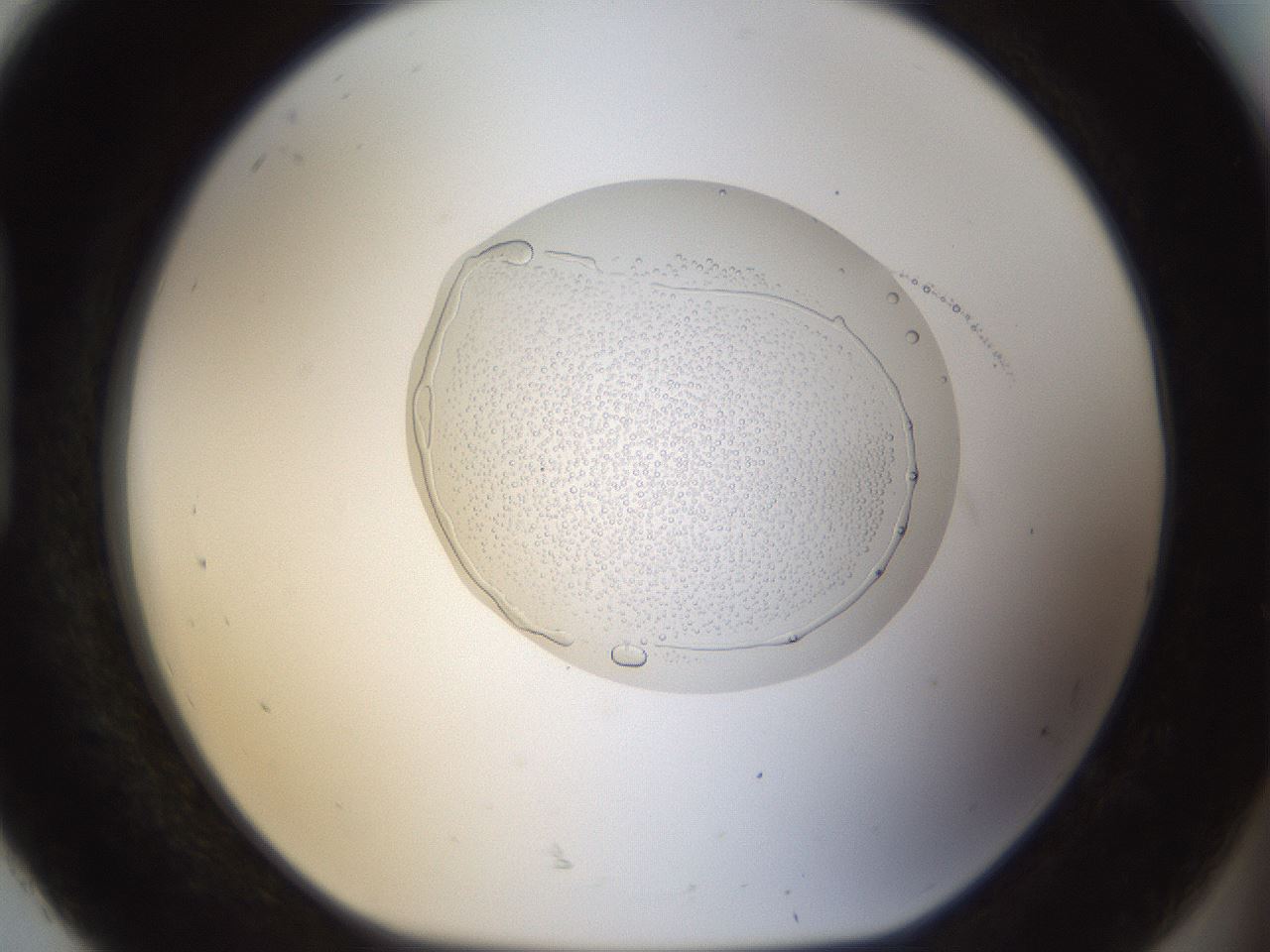 folderID20_plateID1020_batchID1883_wellNum92_profileID1_d1_r42783_ef.jpg