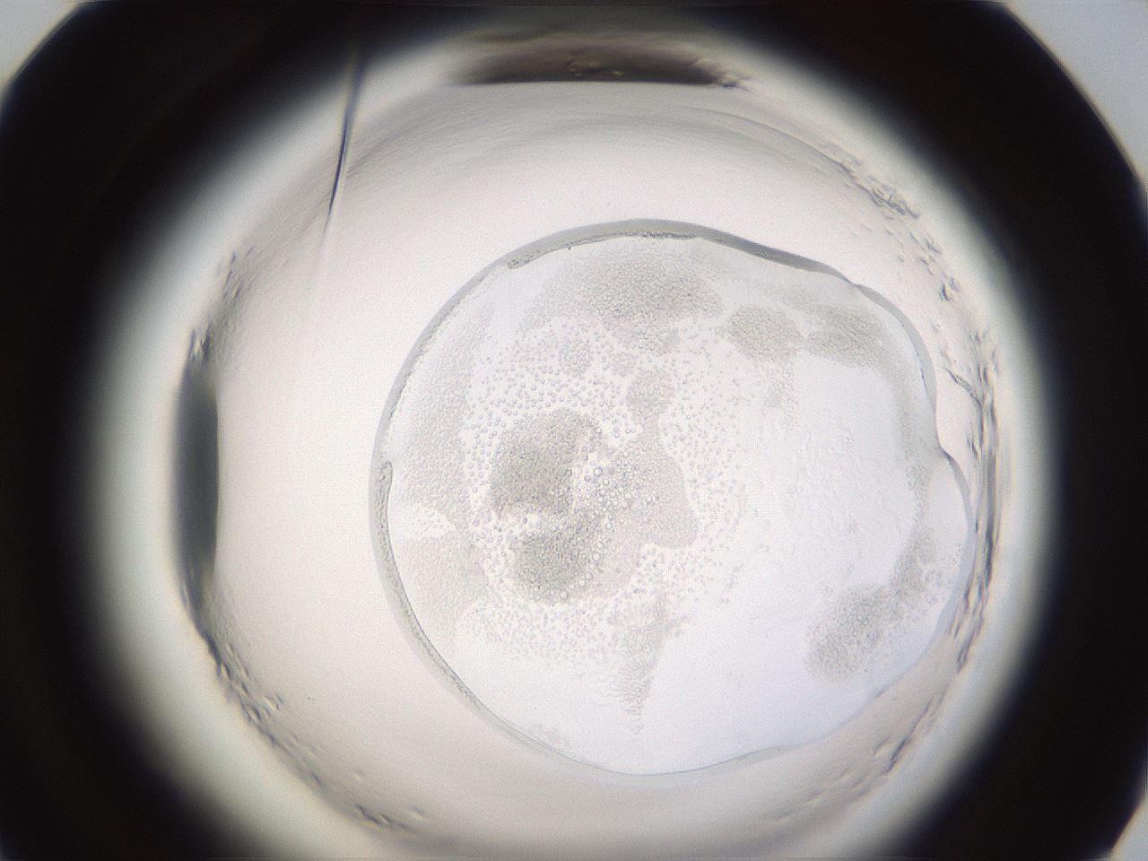 folderID592_plateID2592_batchID13178_wellNum72_profileID1_d1_r203263_ef.jpg