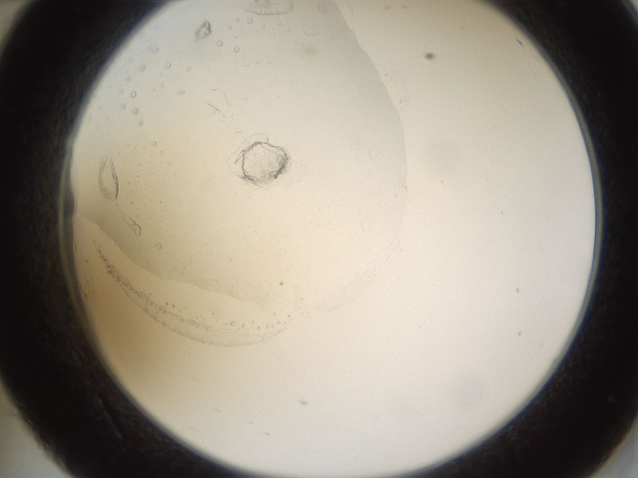 folderID593_plateID1593_batchID6726_wellNum34_profileID1_d2_r105655_ef.jpg