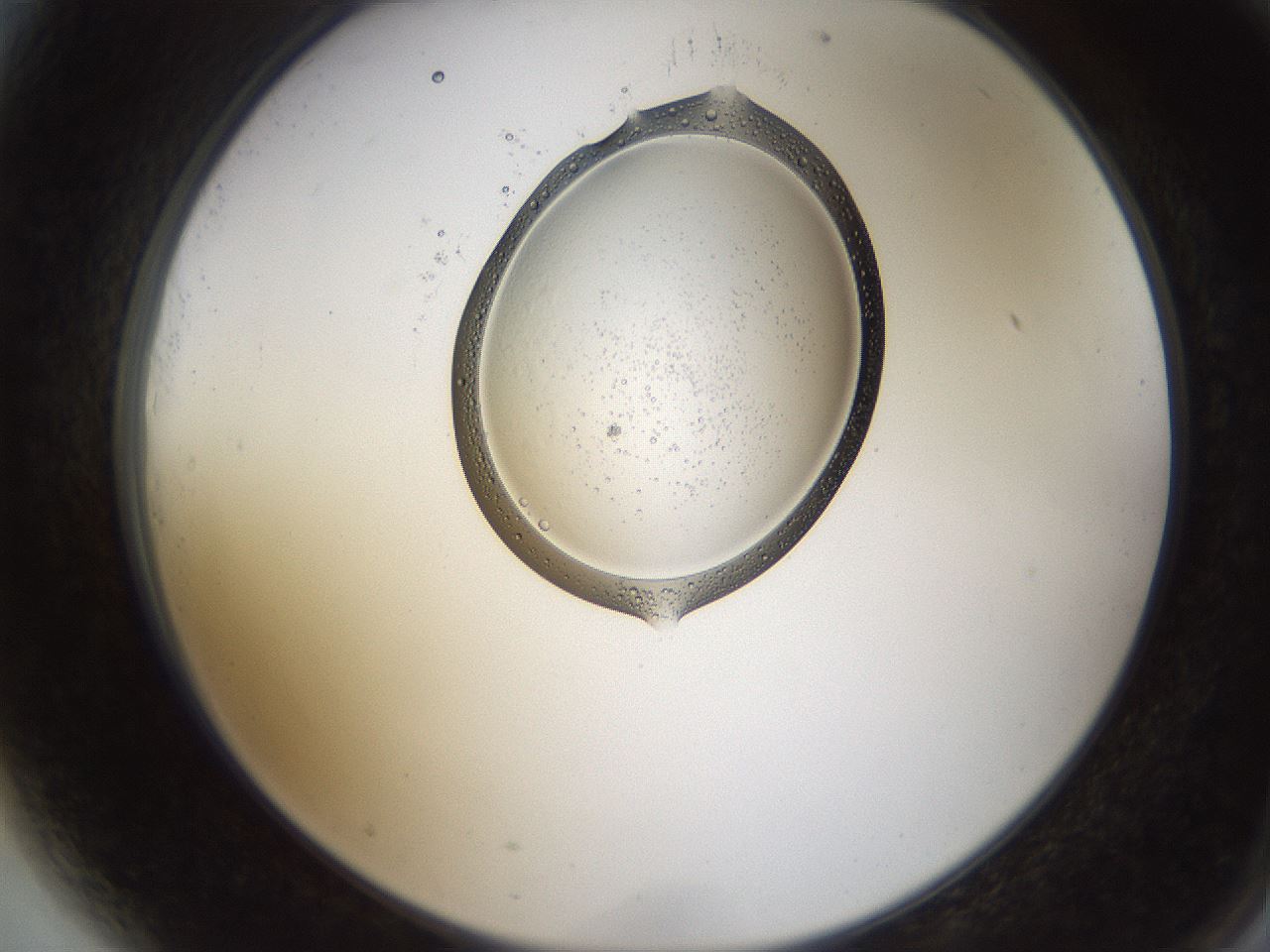 folderID596_plateID1596_batchID6729_wellNum81_profileID1_d2_r106325_ef.jpg