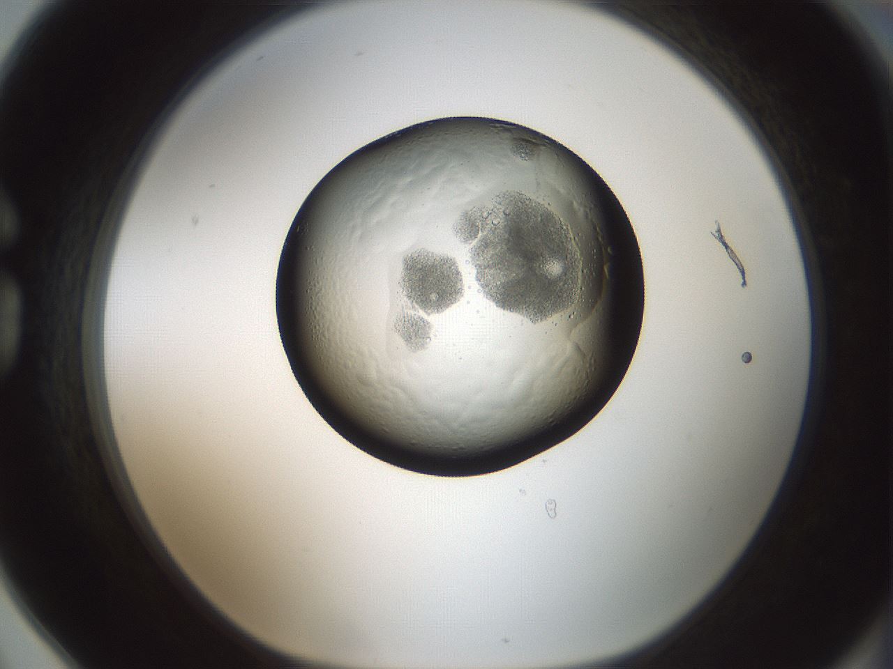 folderID598_plateID1598_batchID6731_wellNum78_profileID1_d1_r106702_ef.jpg