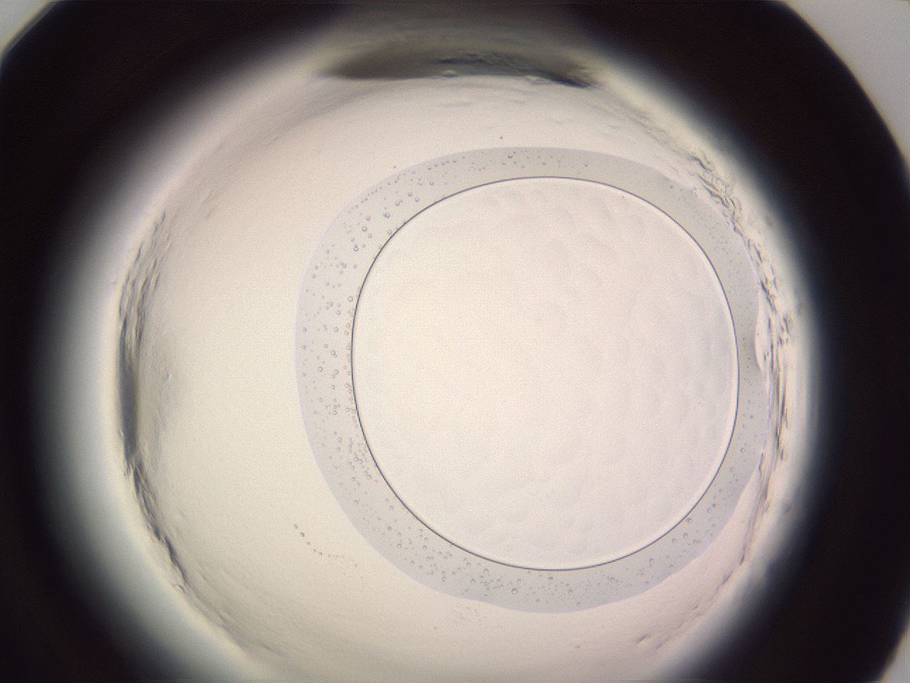 folderID601_plateID2601_batchID13164_wellNum95_profileID1_d1_r199875_ef.jpg