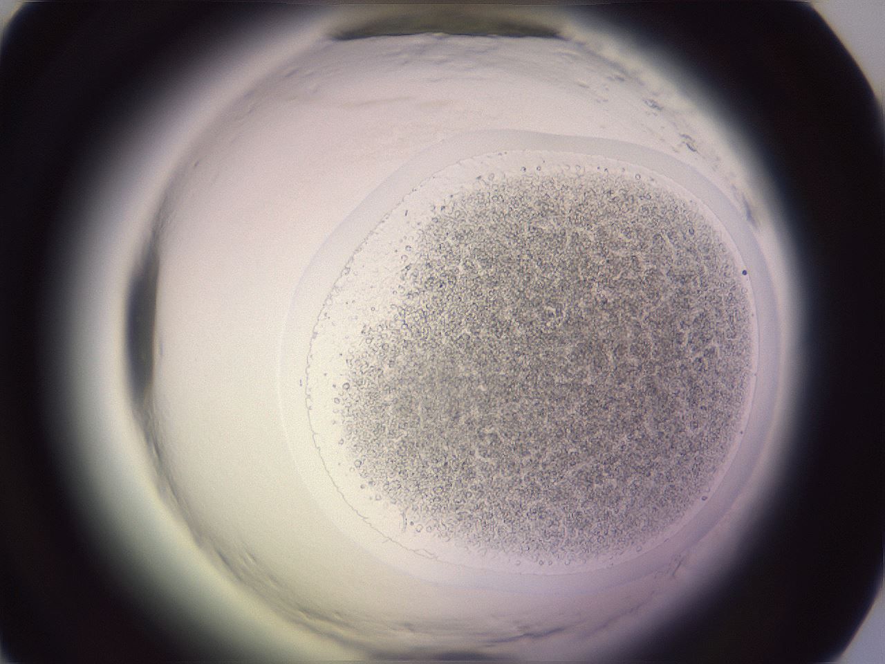 folderID603_plateID2603_batchID13168_wellNum25_profileID1_d1_r201393_ef.jpg