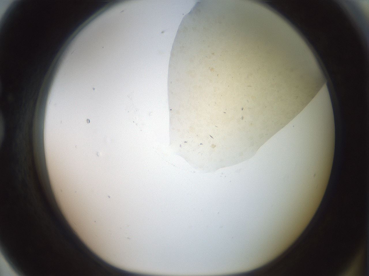 folderID60_plateID2060_batchID9042_wellNum79_profileID1_d1_r139173_ef.jpg