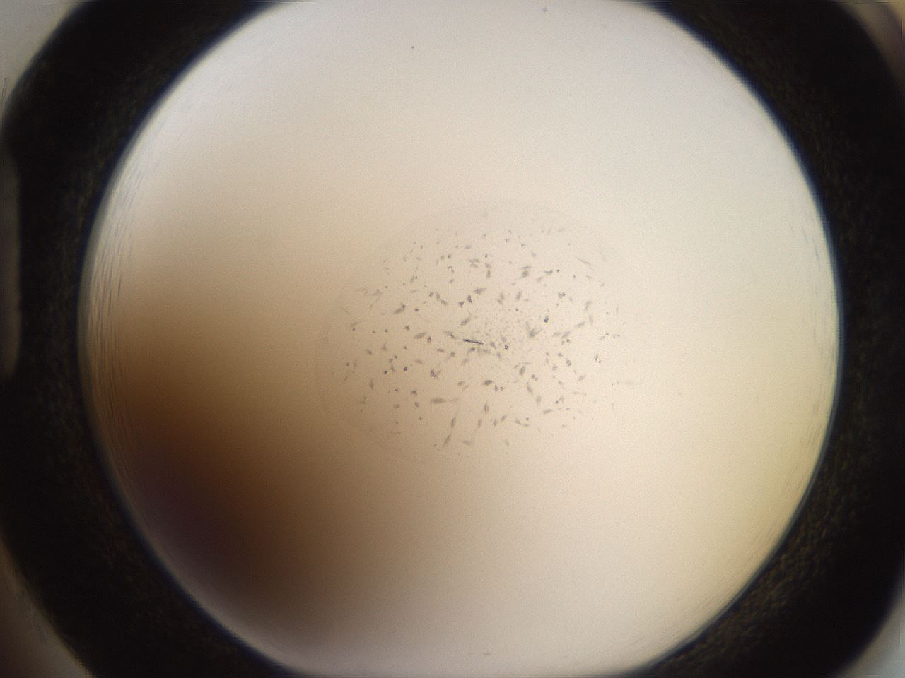 folderID619_plateID1619_batchID6747_wellNum85_profileID1_d1_r107936_ef.jpg