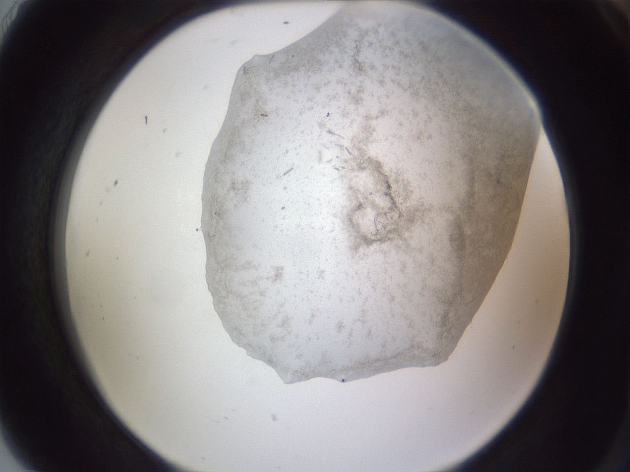 folderID407_plateID2407_batchID11616_wellNum91_profileID1_d2_r178904_ef.jpg