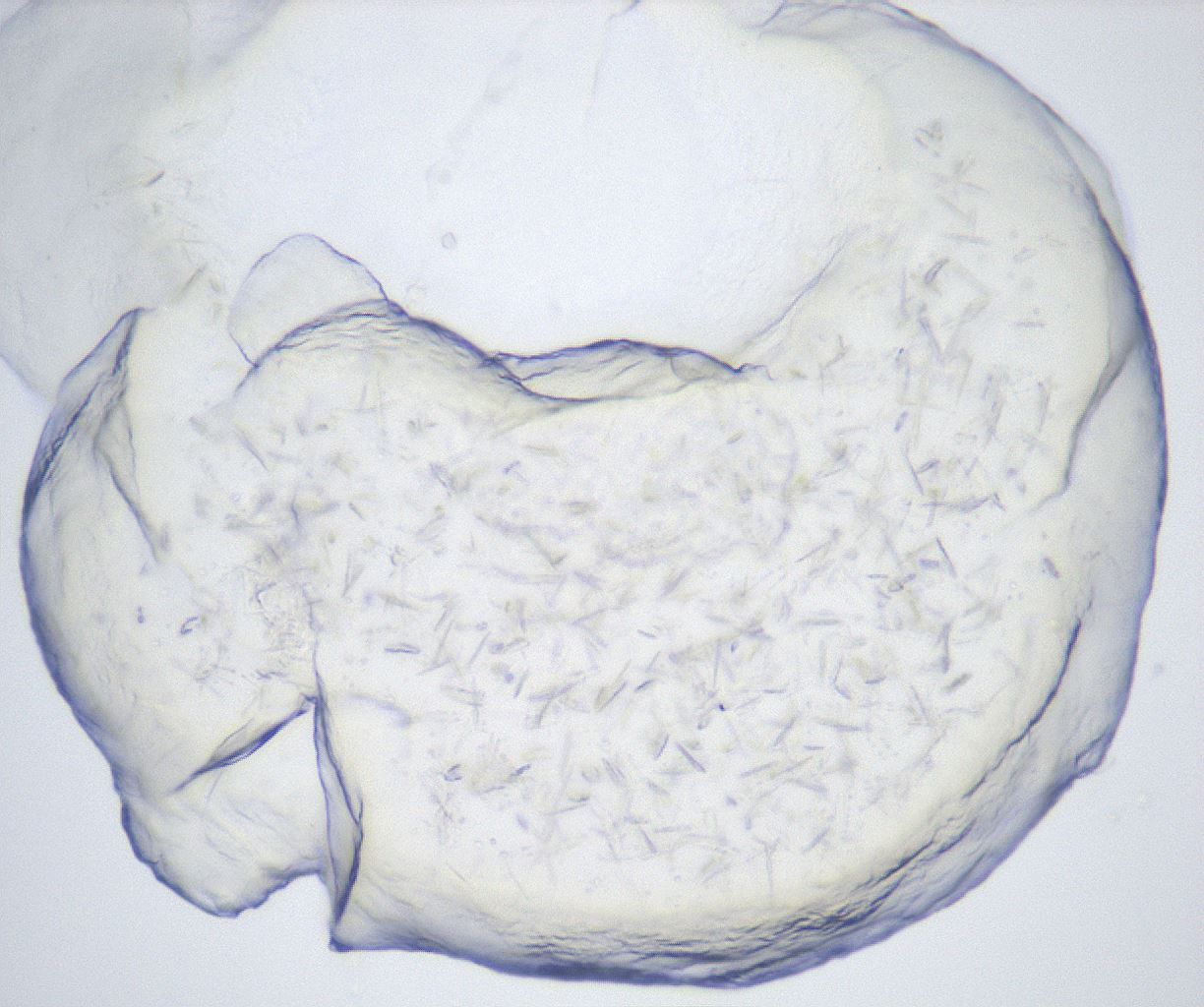 folderID432_plateID2432_batchID11736_wellNum18_profileID1_d1_r185154_ef.jpg