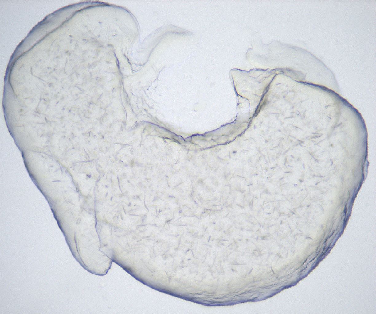 folderID432_plateID2432_batchID11736_wellNum28_profileID1_d1_r185174_ef.jpg