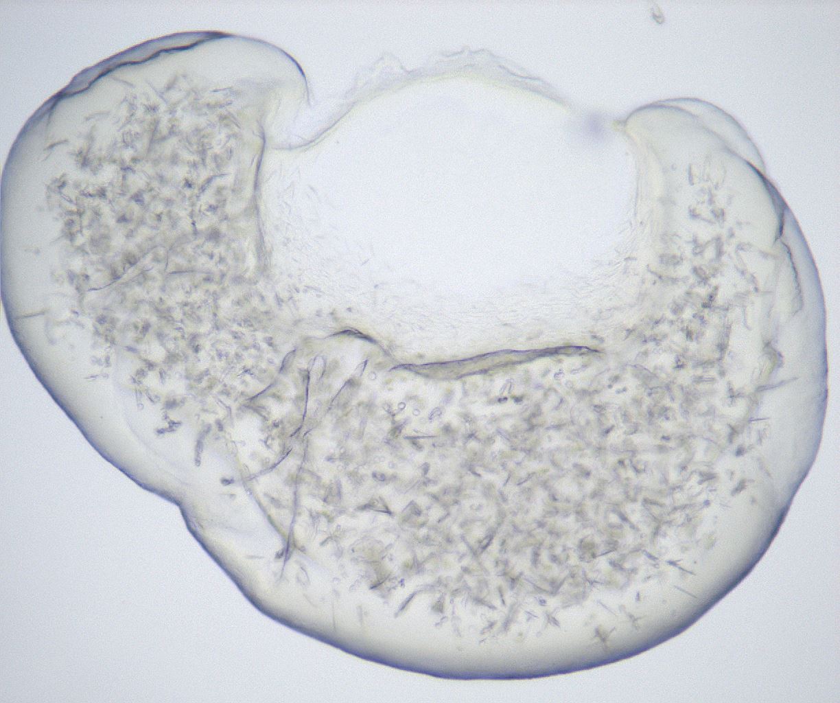 folderID432_plateID2432_batchID11736_wellNum91_profileID1_d1_r185300_ef.jpg
