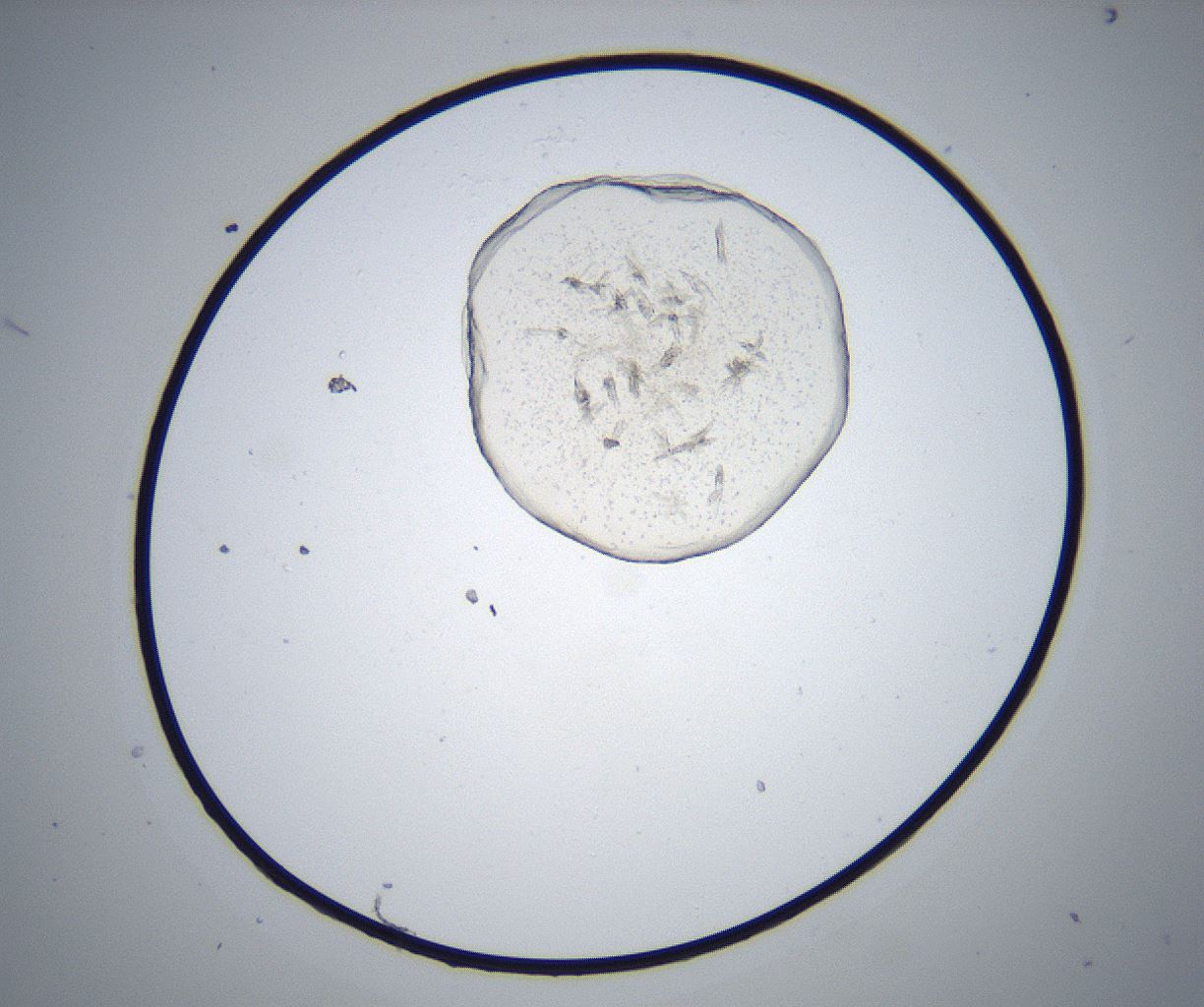 folderID517_plateID2517_batchID12476_wellNum71_profileID1_d1_r189160_ef.jpg