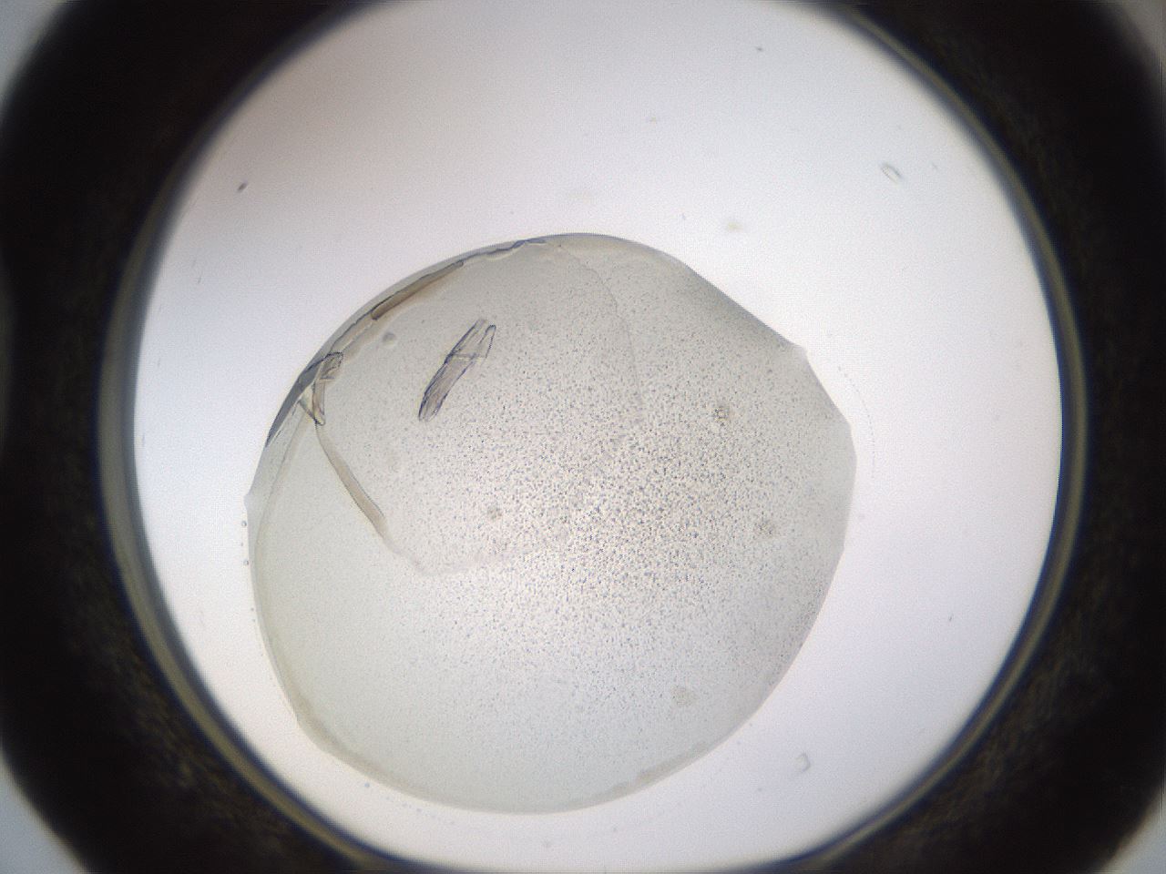 folderID521_plateID1521_batchID5990_wellNum40_profileID1_d1_r97592_ef.jpg