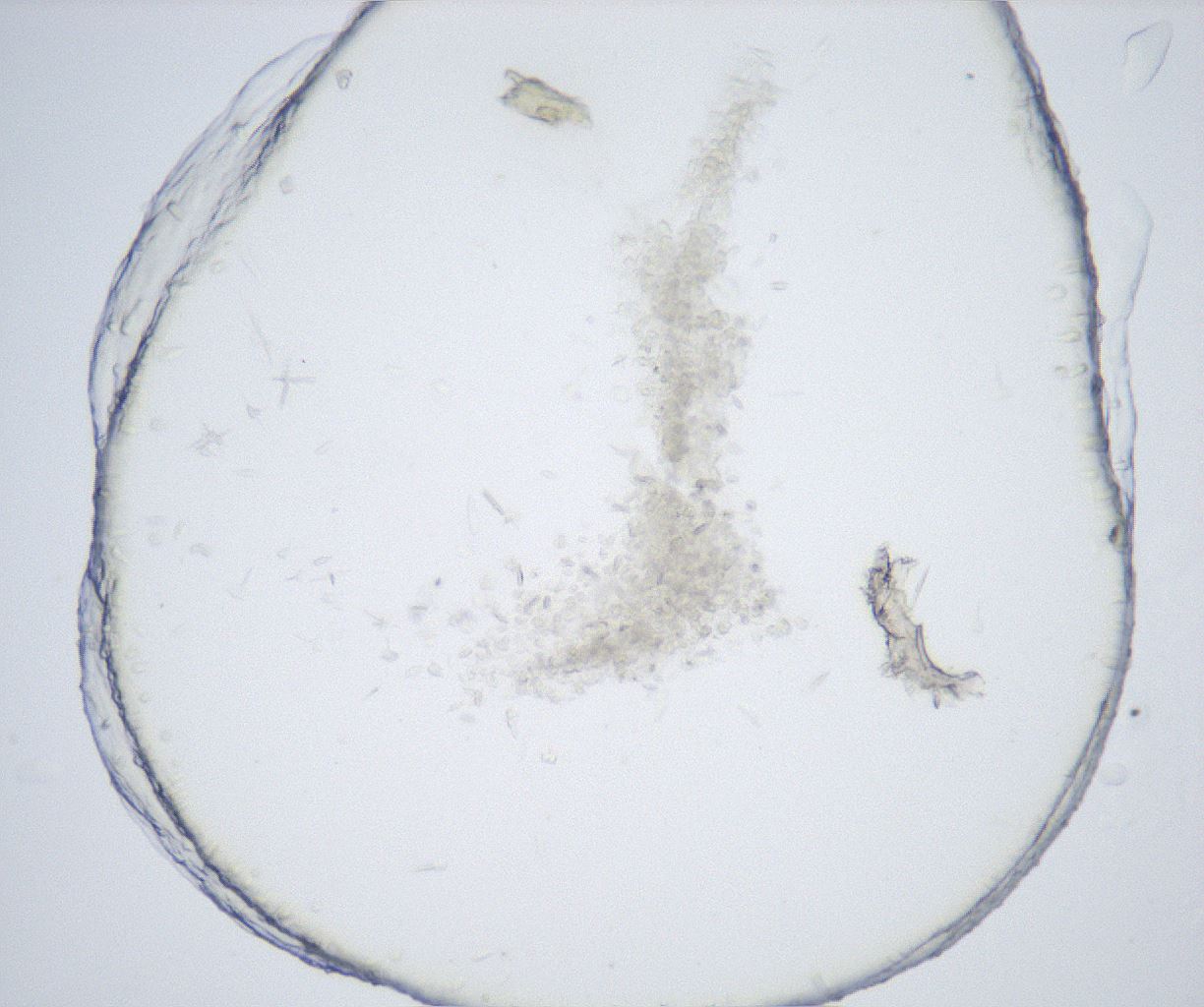 folderID527_plateID2527_batchID12501_wellNum21_profileID1_d1_r191948_ef.jpg