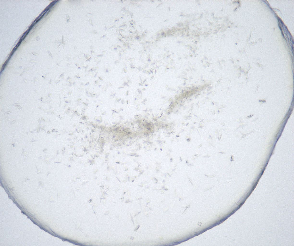 folderID527_plateID2527_batchID12501_wellNum29_profileID1_d1_r191964_ef.jpg