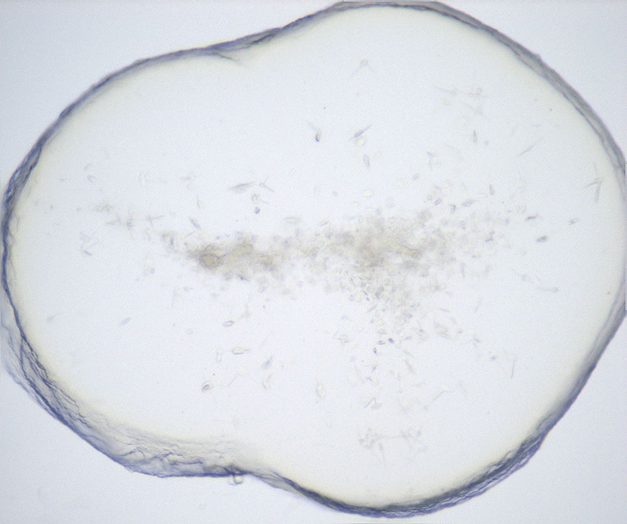 folderID528_plateID2528_batchID12500_wellNum30_profileID1_d1_r191774_ef.jpg