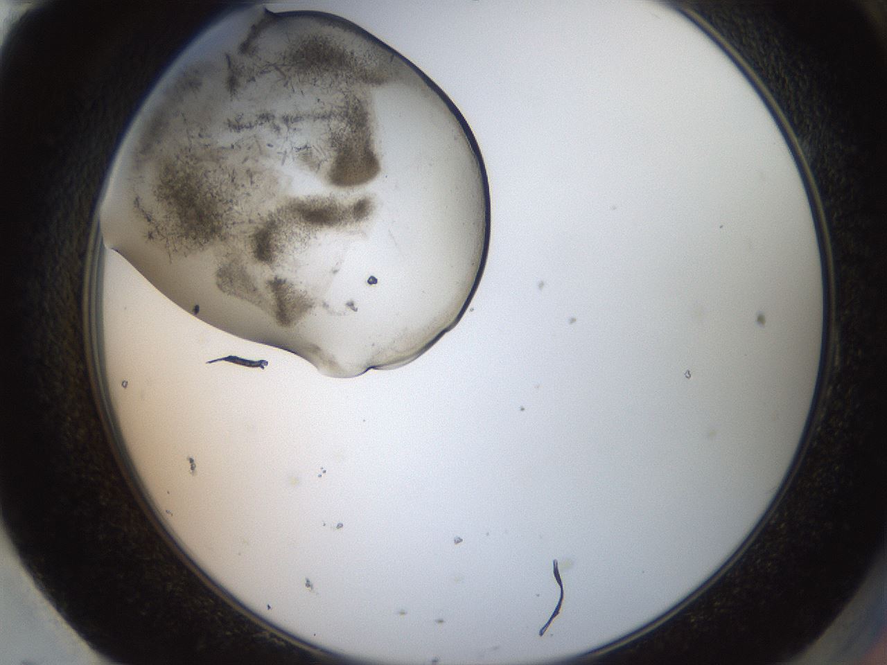 folderID569_plateID2569_batchID12915_wellNum95_profileID1_d2_r196326_ef.jpg