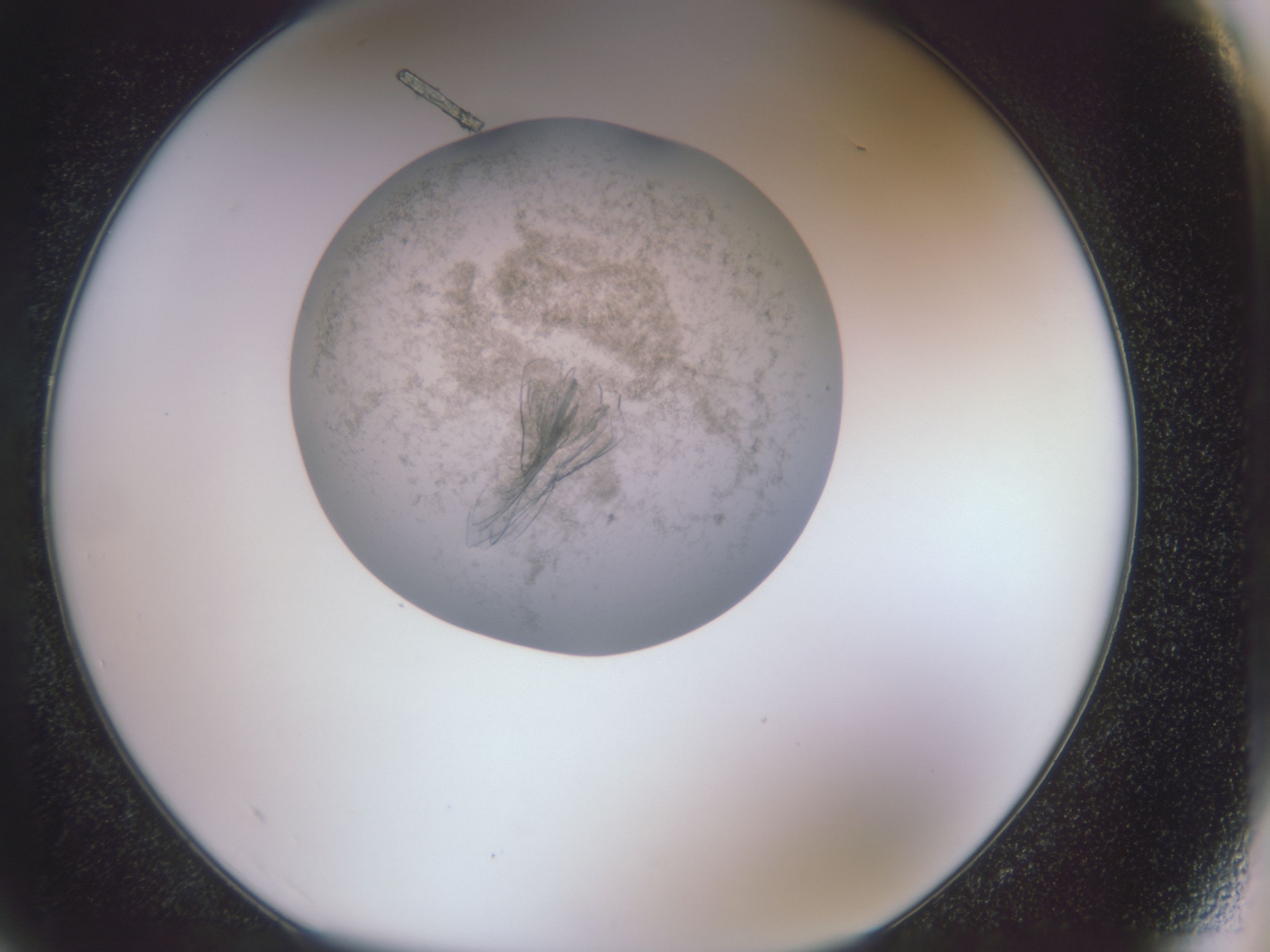 folderID588_plateID588_batchID558_wellNum75_profileID1_d1_r12821_ef.jpg