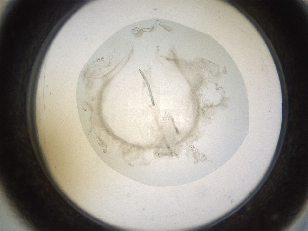 folderID575_plateID1575_batchID6363_wellNum44_profileID1_d2_r103206_ef.jpg