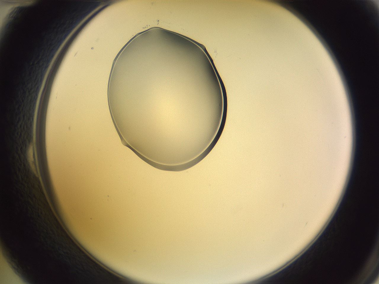 folderID276_plateID1276_batchID4164_wellNum24_profileID1_d2_r72999_ef.jpg
