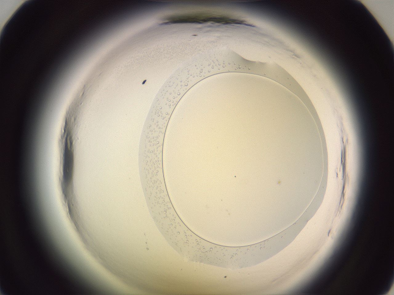 folderID601_plateID2601_batchID13164_wellNum35_profileID1_d1_r199695_ef.jpg