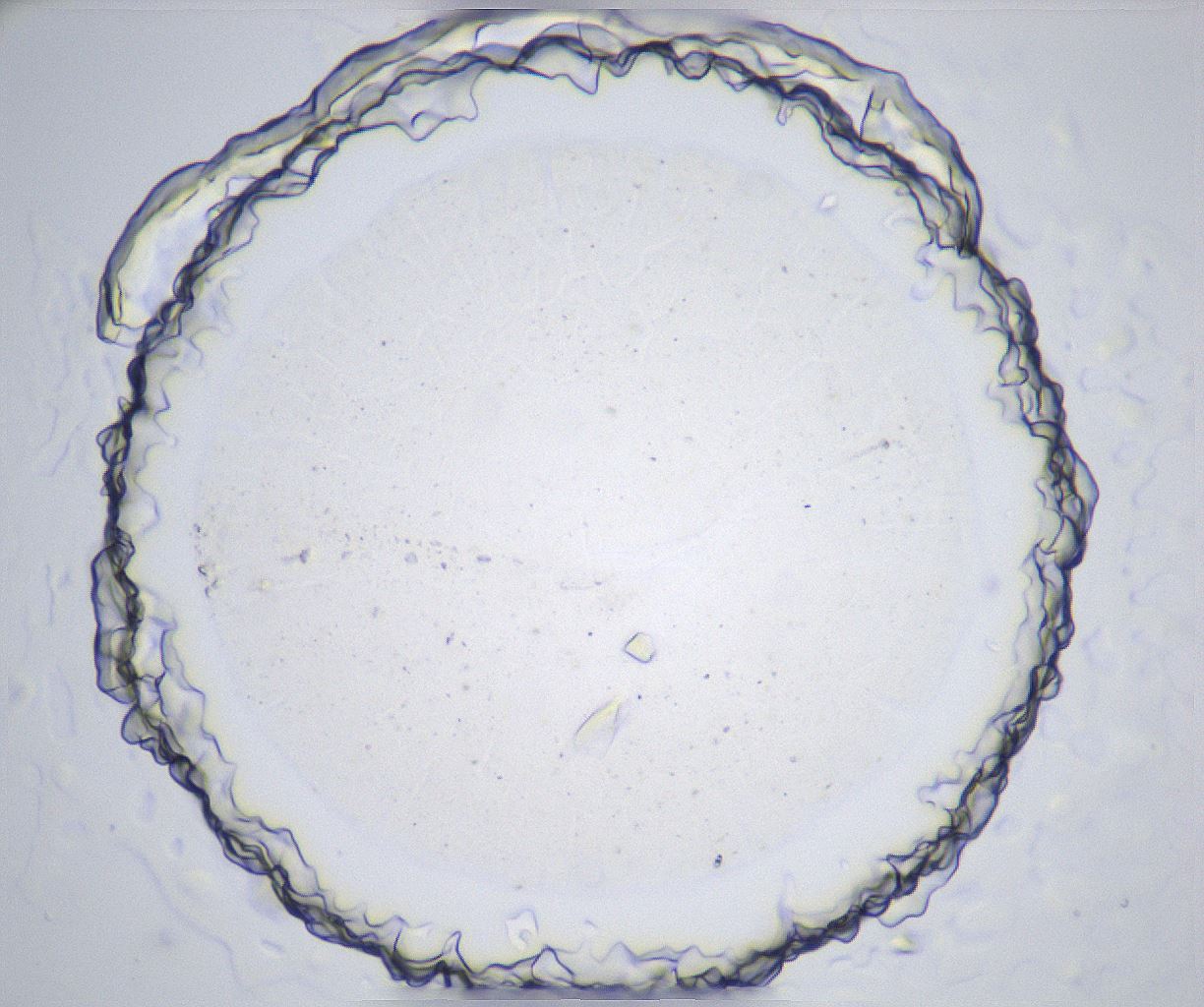 folderID360_plateID2360_batchID11086_wellNum67_profileID1_d1_r168295_ef.jpg