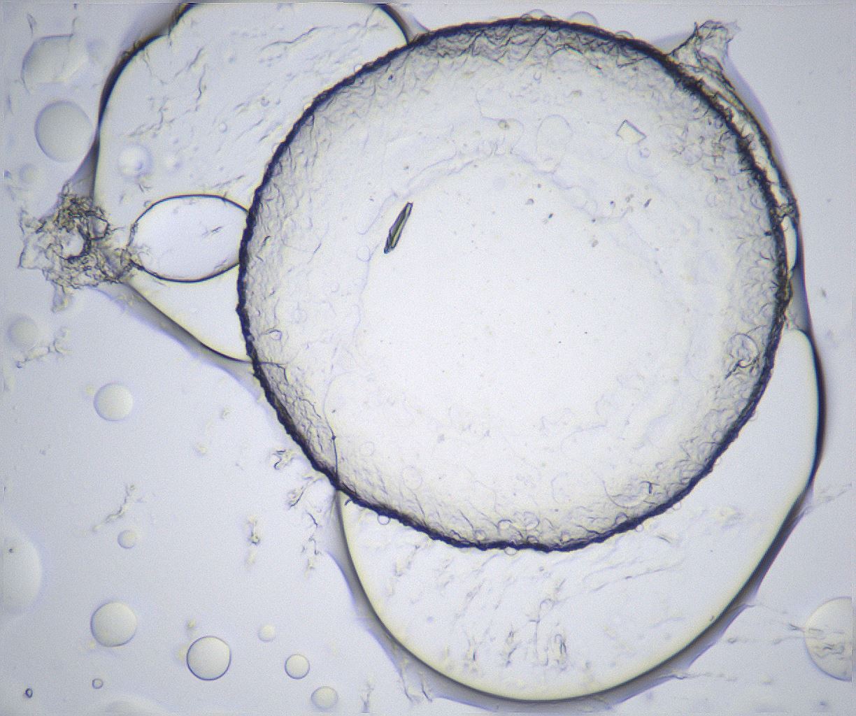 folderID361_plateID2361_batchID11084_wellNum46_profileID1_d1_r167869_ef.jpg
