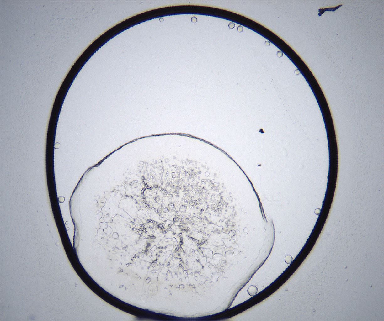 folderID362_plateID2362_batchID11079_wellNum17_profileID1_d1_r167427_ef.jpg